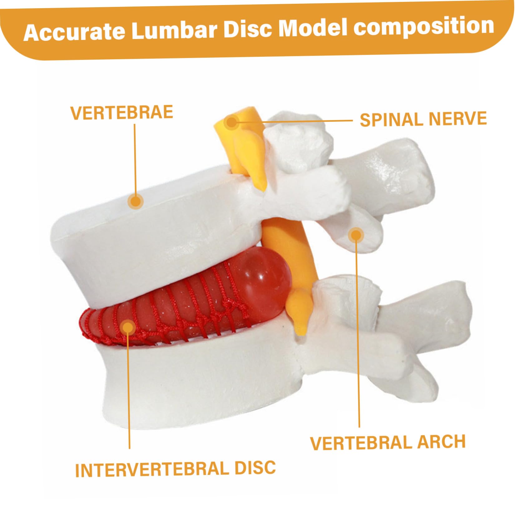 Spinal Disc NLShan NLShan Human Anatomical Lumbar Disc Herniation Model ...