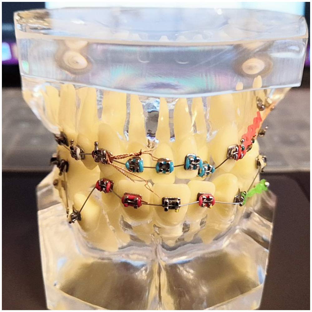 Buy FSFF Dental Malocclusion Orthodontic Teeth Model with Brackets