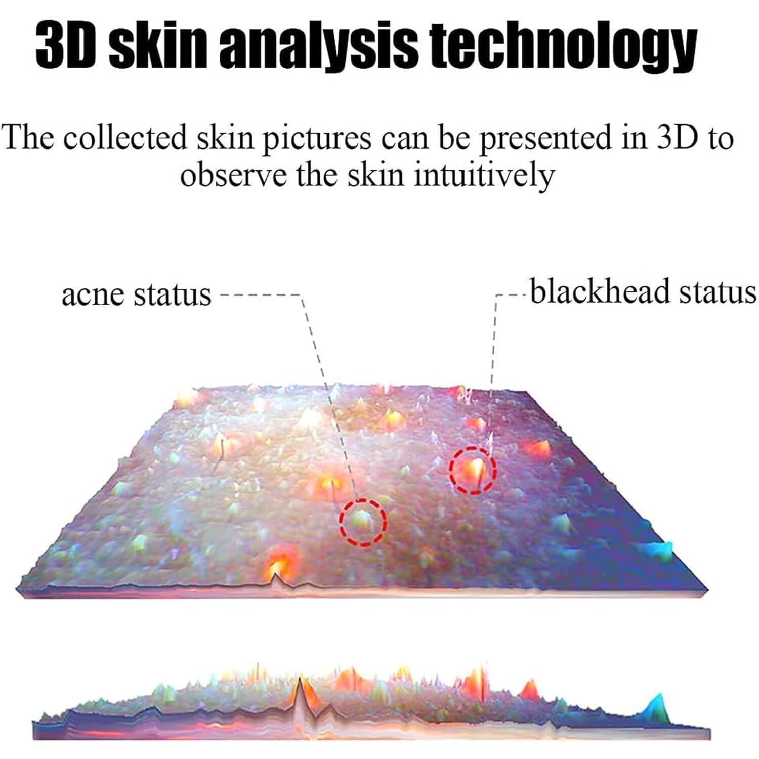 Professional Facial Analyzer, 3D Skin Detector, Intelligent Skin Analyzer, Equipped with 12-megapixel Dual Cameras, Suitable for Beauty Salons