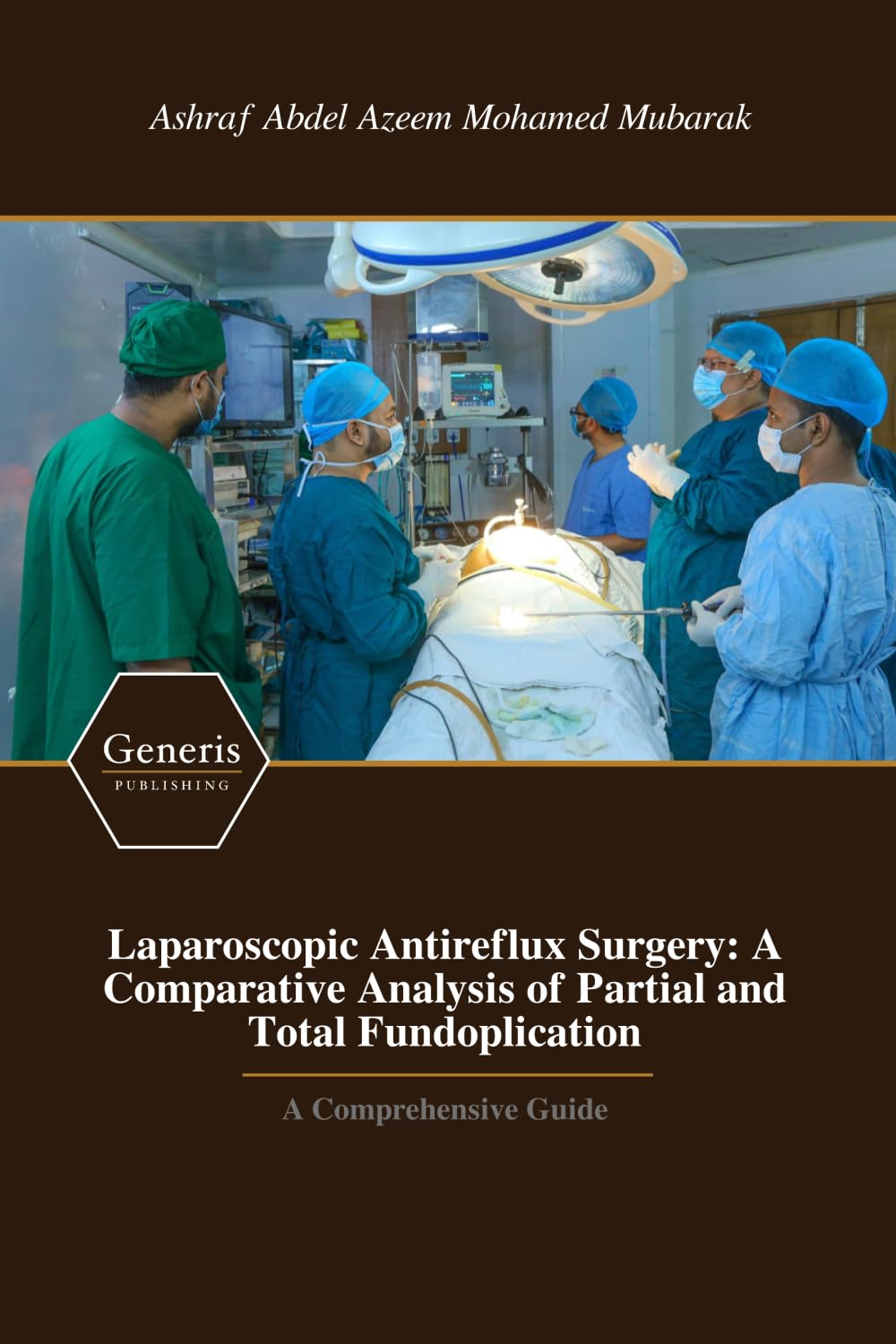Laparoscopic Antireflux Surgery: A Comparative Analysis of Partial and Total Fundoplication: A Comprehensive Guide