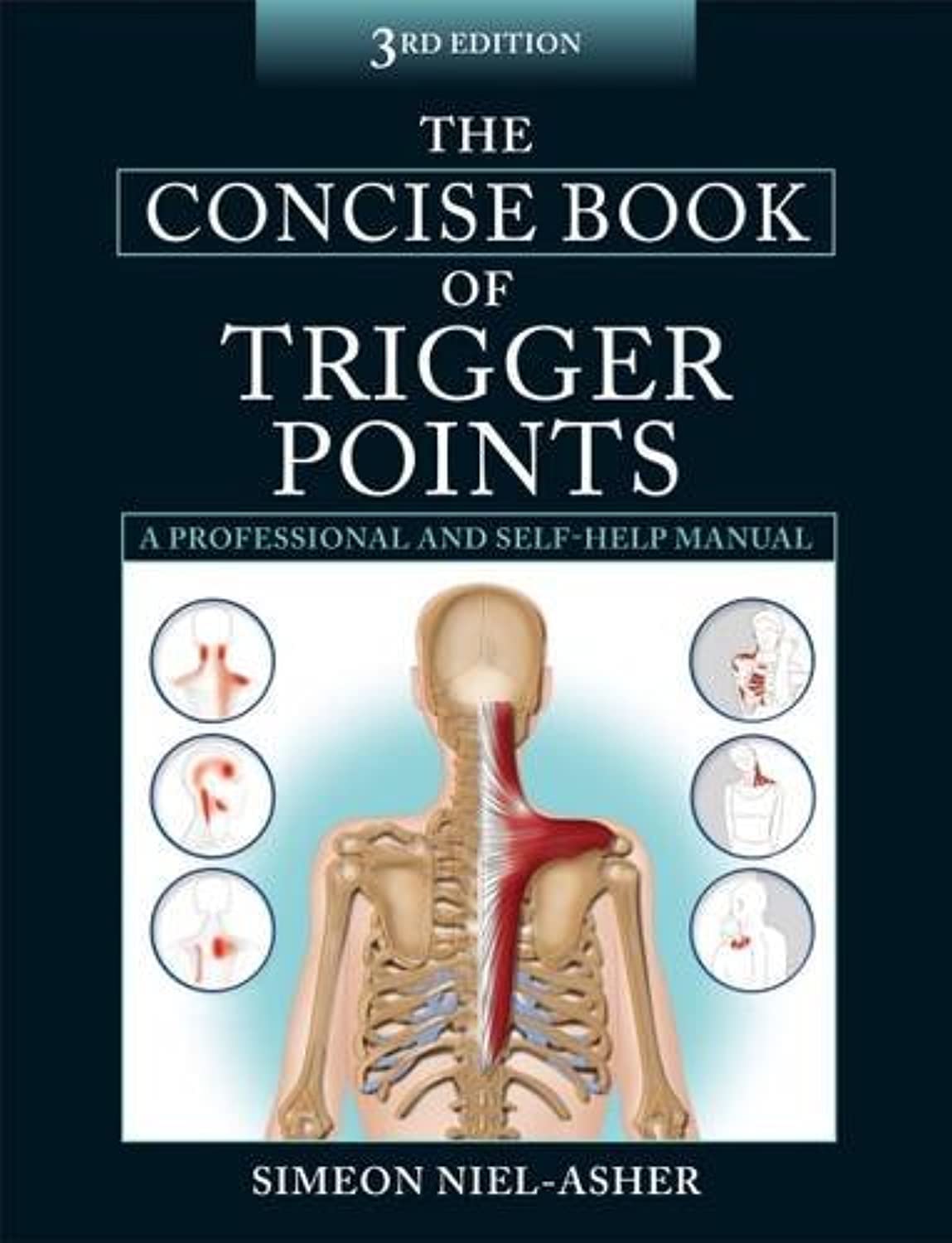 The Concise Book of Trigger Points Paperback – Big Book, 31 October 2014