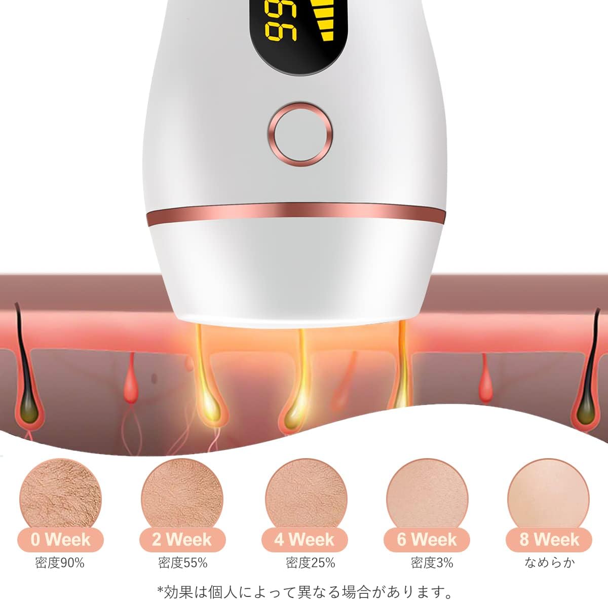 最大67 オフ 脱毛器 光美容器 5段階調節 99万回照射 2つ照射モード 家庭用 男女兼用 Lakshyaayurveda Com