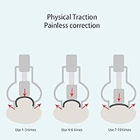 Vista 2 de Herramienta de cuidado de pies encarnados para el cuidado de los pies, abrazadera de uñas de acero inoxidable, herramientas de acero inoxidable