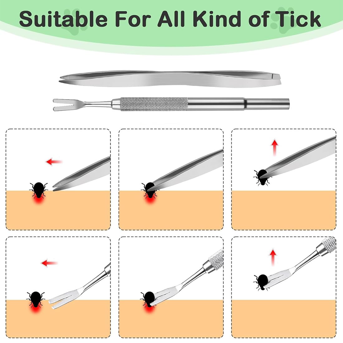Lot de 5 Pinces à tiques avec étui - Pince pour Chats et Chiens - Tire Tique Humain, Anti Tique Chien et Chat - Protection Contre Les Animaux Domestiques et Les Enfants - Crochet à tiques