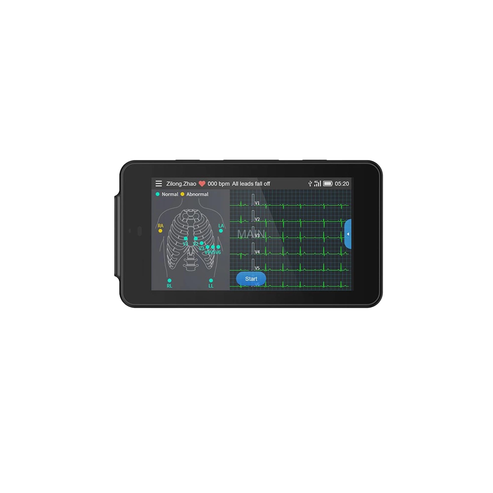 "PX31" MONITOR ECG TASCABILE PCECG-500