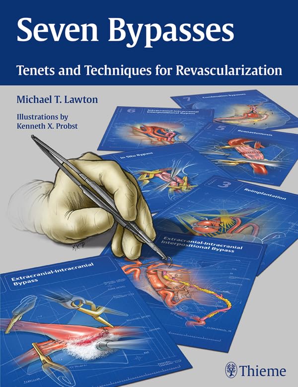 Seven Bypasses: Tenets and Techniques for Revascularization (English Edition)