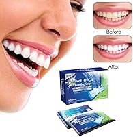 Vista 2 de Arinda Tiras de blanqueamiento de dientes de gel para blanquear los dientes, kit de higiene bucal para carillas de dientes