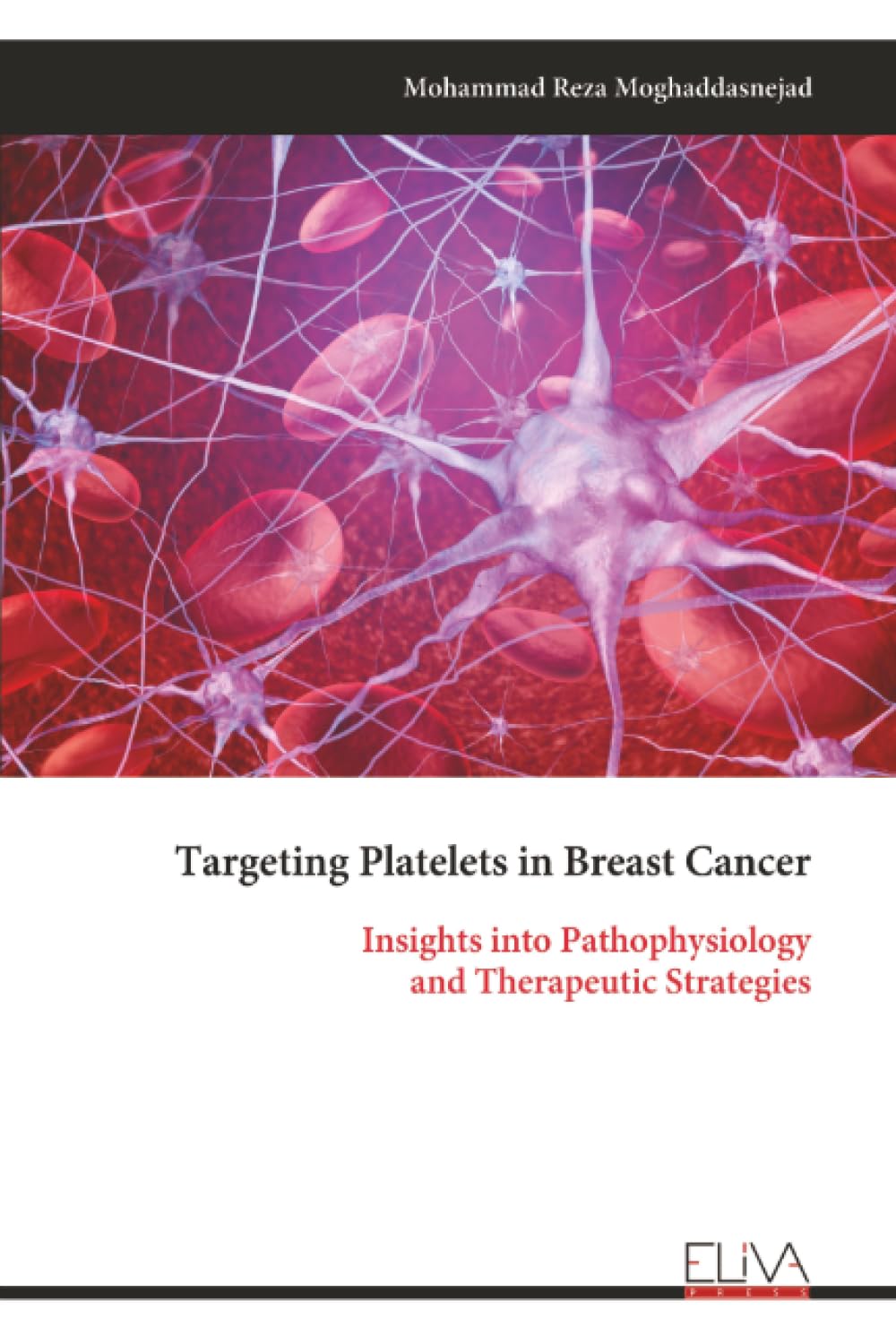 Targeting Platelets in Breast Cancer: Insights into Pathophysiology and Therapeutic Strategies