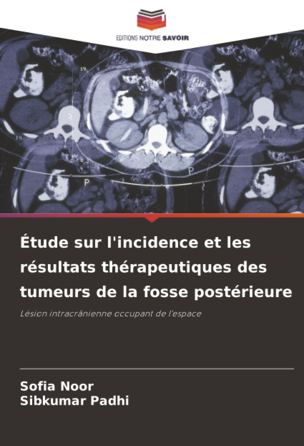 Étude sur l'incidence et les résultats thérapeutiques des tumeurs de la fosse postérieure: Lésion intracrânienne occupant de l'espace