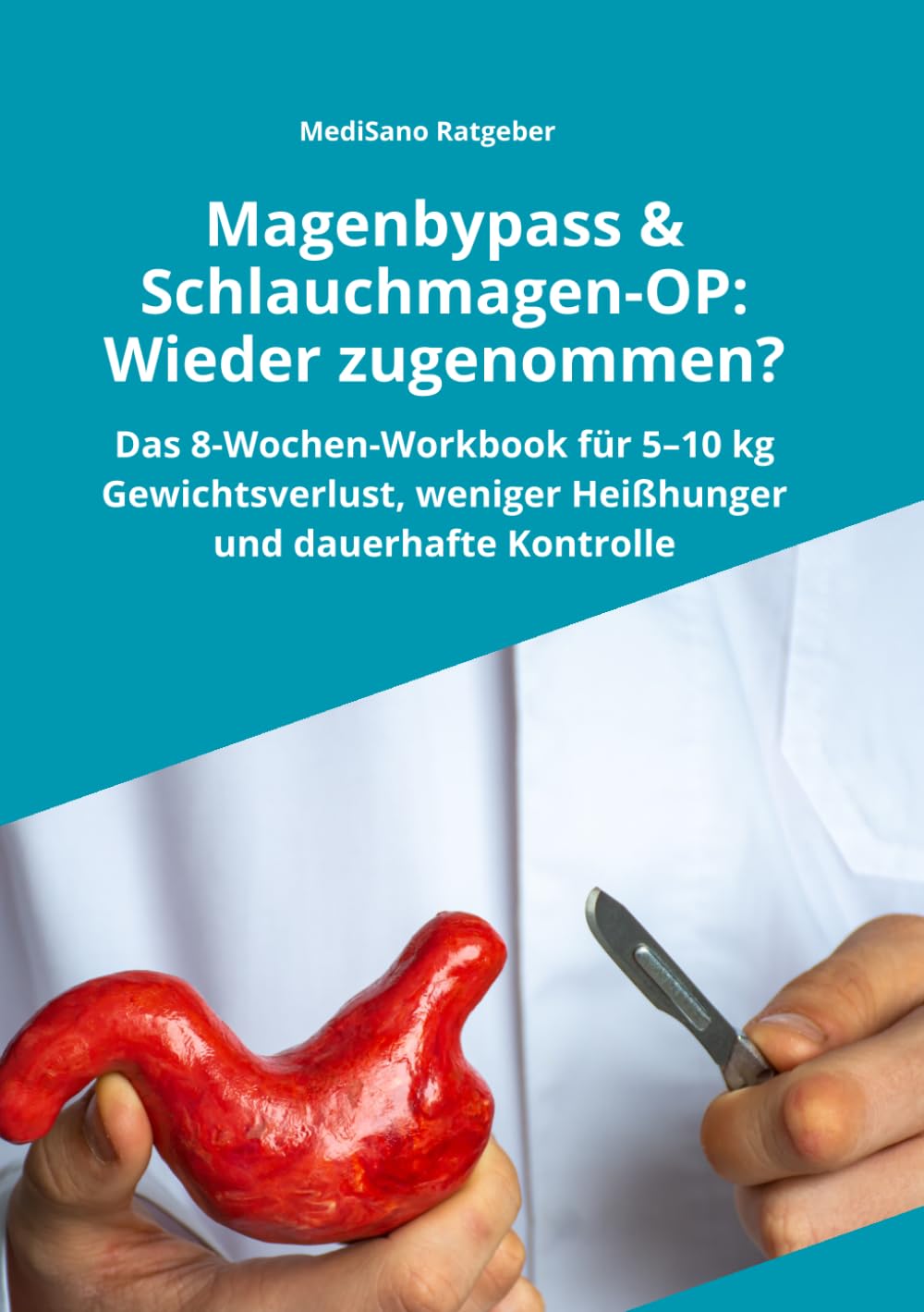 Magenbypass und Schlauchmagen-OP: Wieder zugenommen?: Das 8-Wochen-Workbook, um 5–10 kg gesund zu verlieren, Heißhunger zu stoppen und dauerhaft die ... zurückzugewinnen (MediSano Praxis-Workbooks)