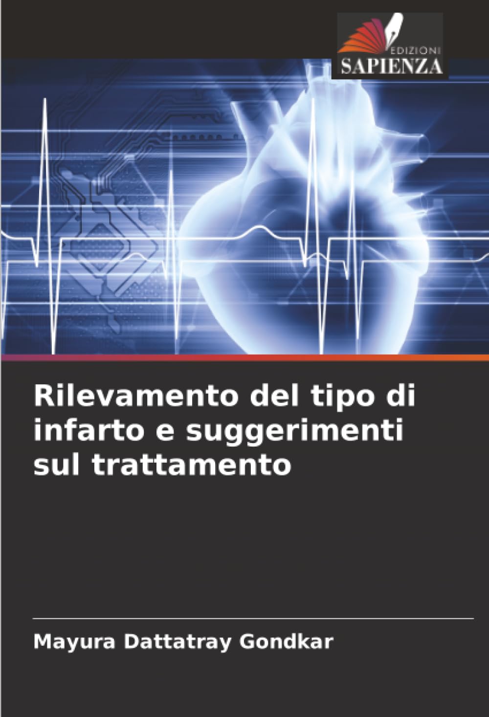 Rilevamento del tipo di infarto e suggerimenti sul trattamento