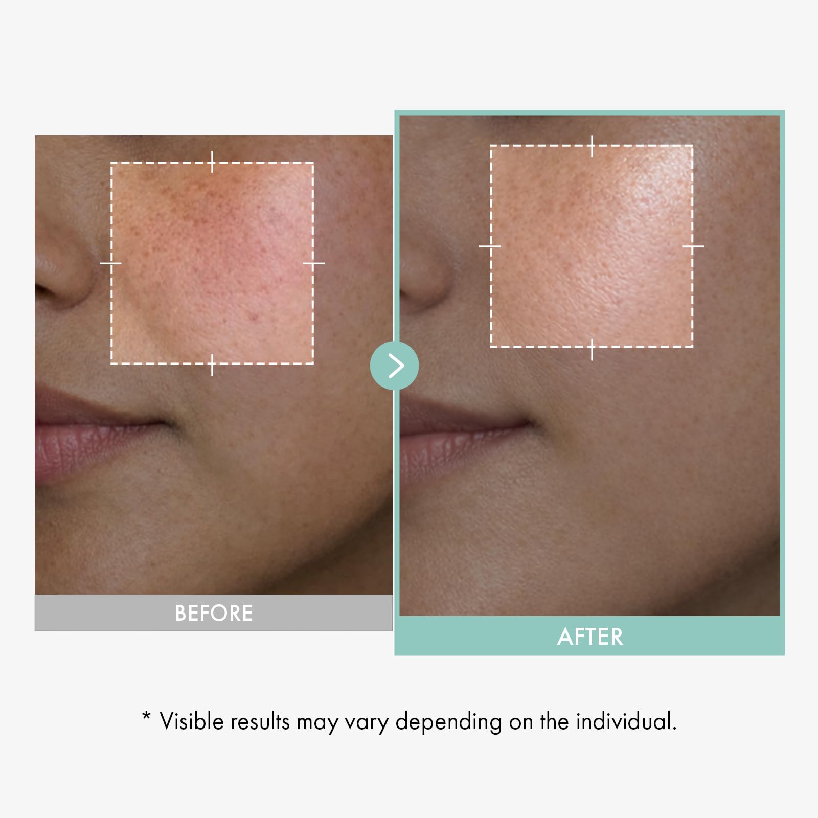 TOSOWOONG Glycolic Acid 10% Exfoliating Serum with Niacinamide