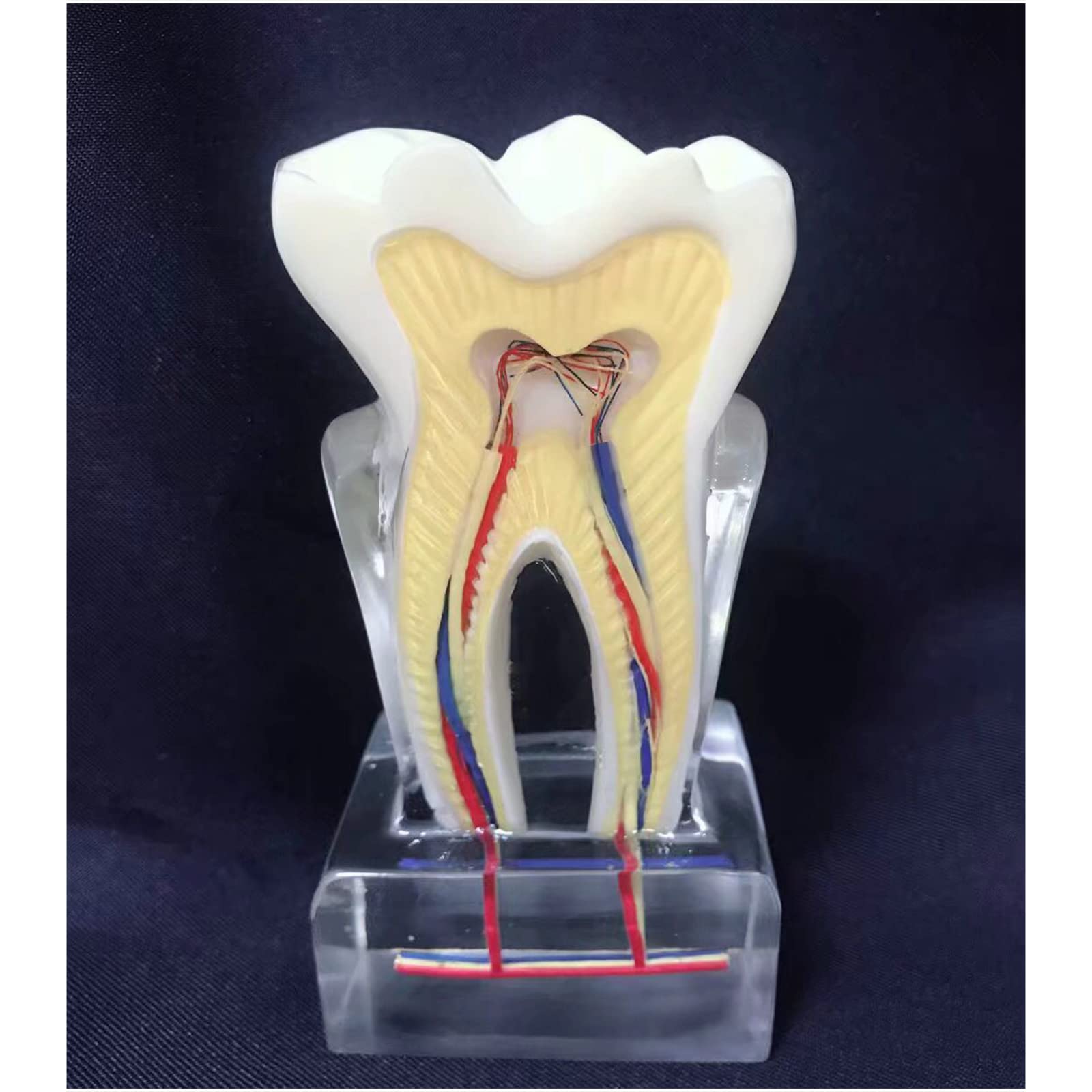 6 modèles de profil dentaire – Modèle d'étude – Modèle d'affichage dentaire – Modèle anatomique des dents – Instrument d'enseignement clair – Pour communication médecin-patient
