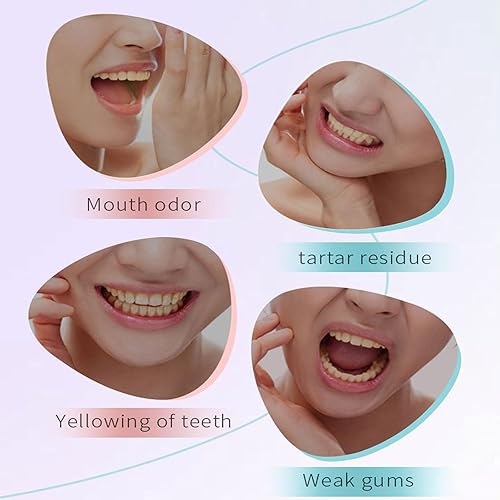 Miniatura 2 de Pasta de dientes blanqueadora de nicotinamida, pasta de dientes de niacinamida, limpia la boca (1PCS)