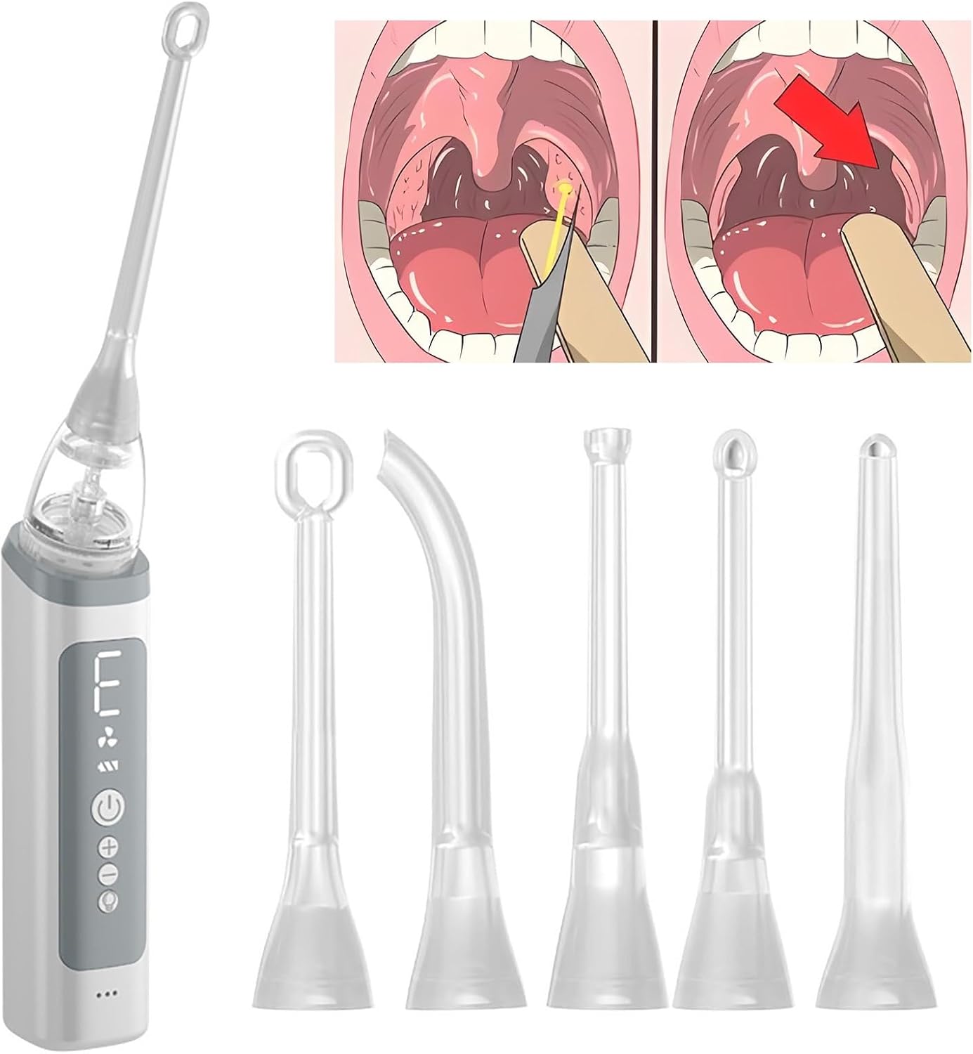 Tonsil Stone Remover 3 Level Suction Tonsil Stone Cleaner Instant Suction Tool Oral Cleansing Oral Care Easy to Use(009)