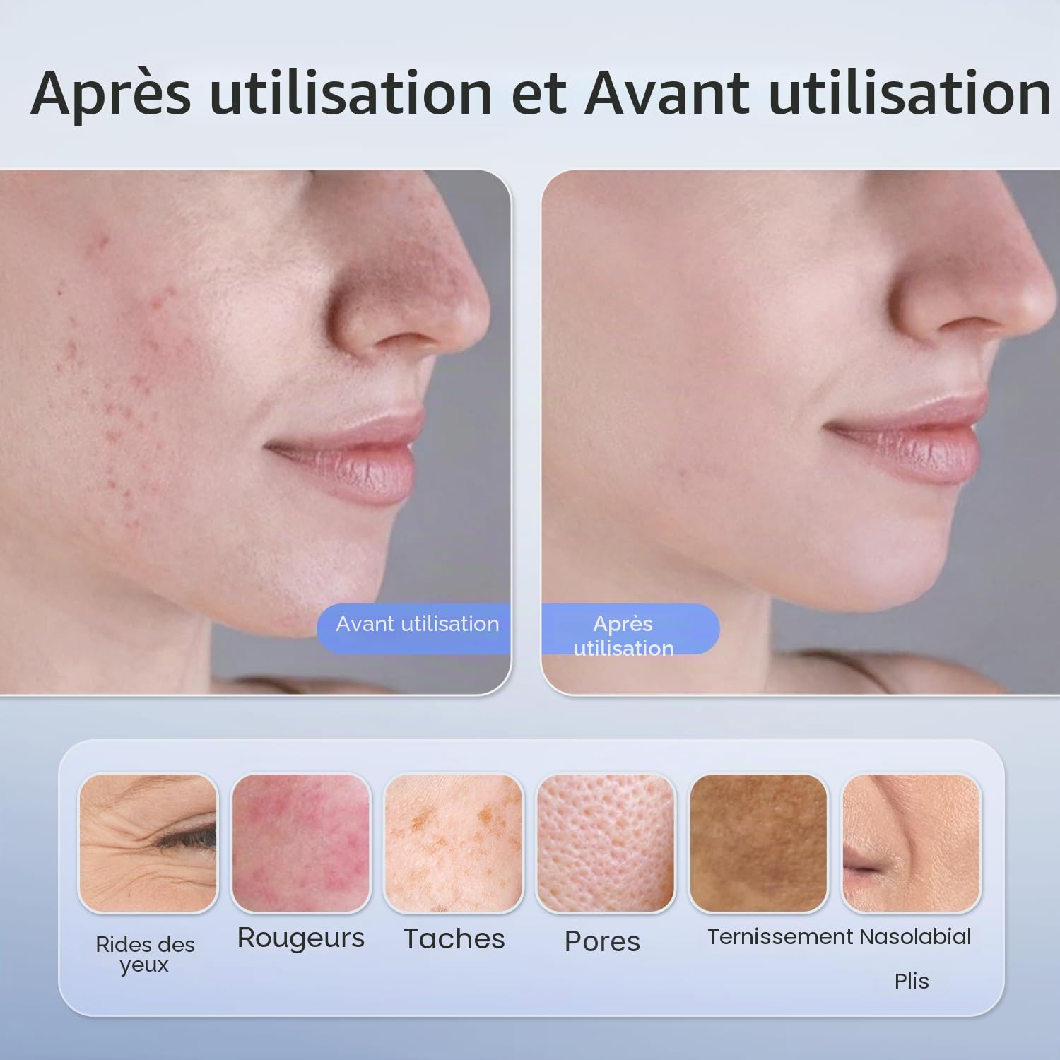 Masque LED Visage Luminothérapie – 4 Modes de Soin, Masque Thérapie Lumière Rouge avec Minuterie Intelligente, Système PDT Anti-Âge à Domicile – Approuvé par la FDA