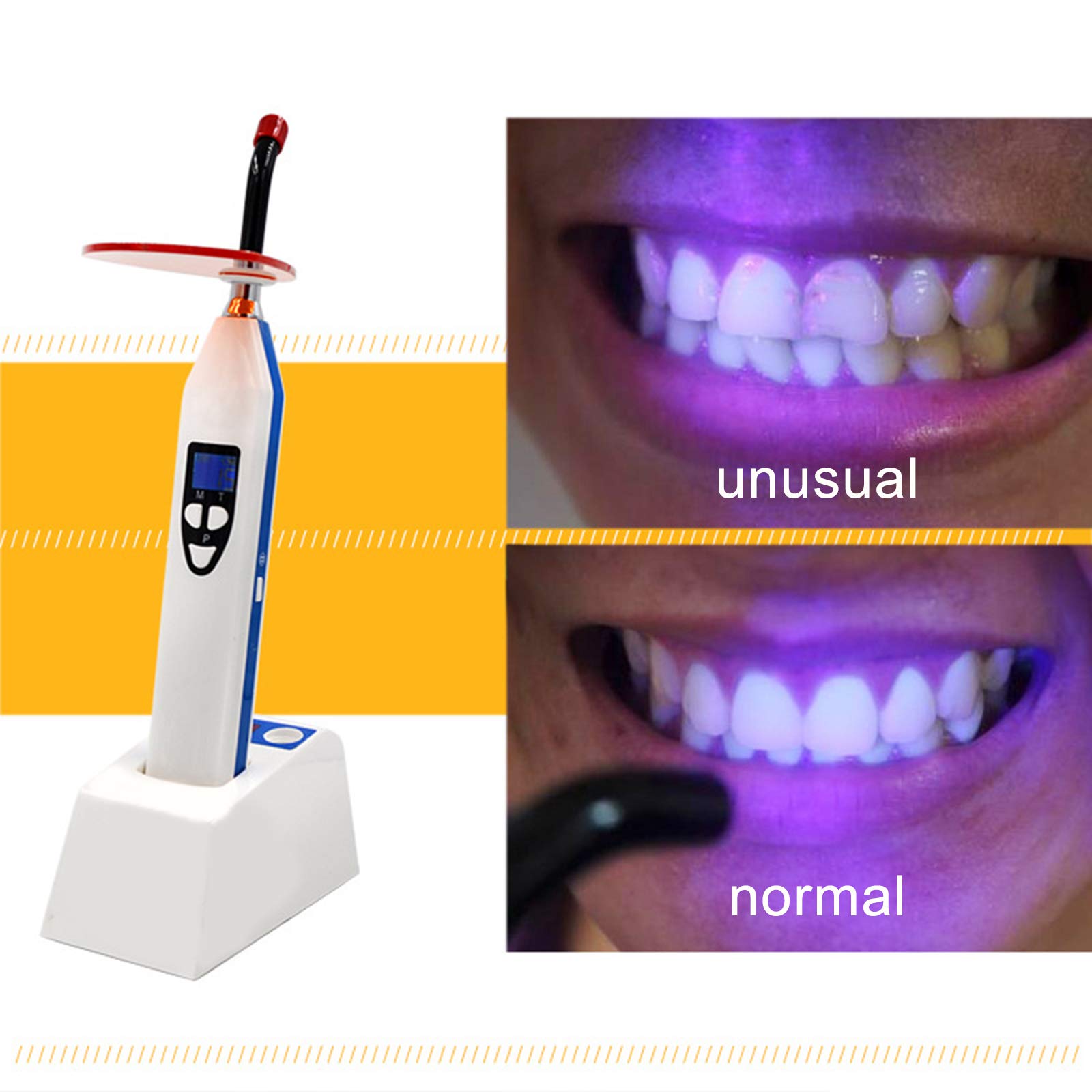 Amazon.co.jp: LED歯科用硬化ライト歯科重重合樹脂硬化歯科用材料