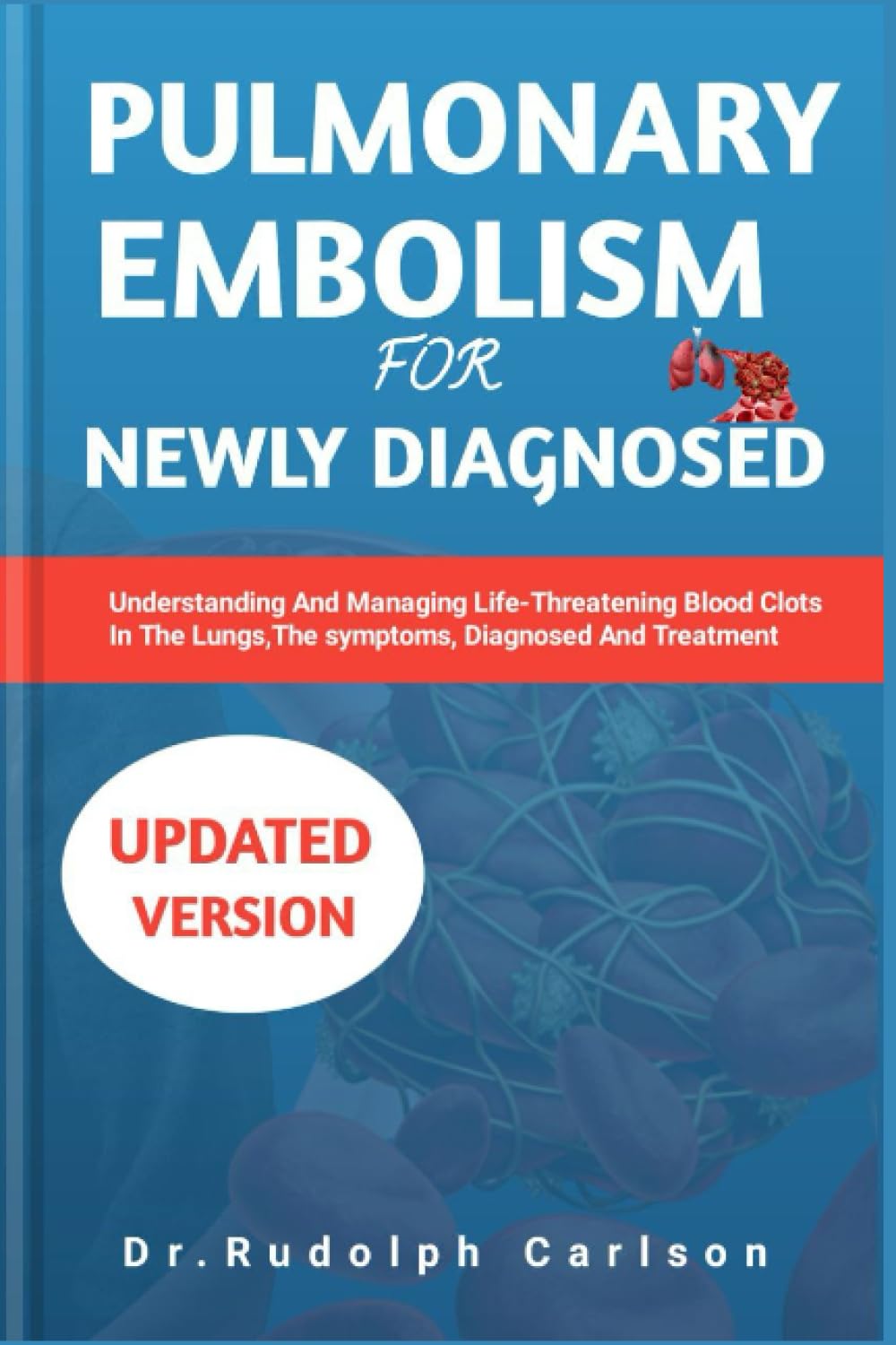 PULMONARY EMBOLISM FOR NEWLY DIAGNOSED: Understanding And Managing Life Threatening Blood Clots In The Lungs,The Symptoms,Diagnosed And Treatment. (Healthy Heart Chronicle)