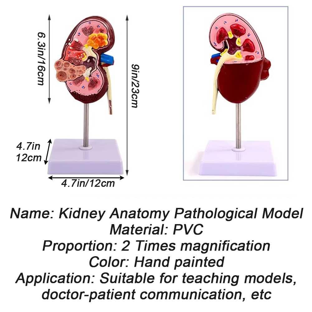 Model Nerki Z 2 Odłączanymi Częściami I 24 Cyfrowymi Etykietami Oraz Instrukcjami Anatomicznymi Dotyczącymi Ułożenia, Pozwalającymi Zrozumieć Strukturę Ludzkiej Nerki