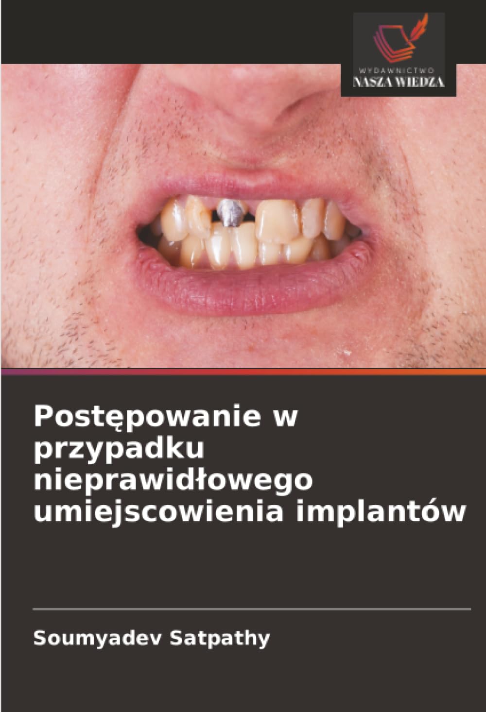 Postępowanie w przypadku nieprawidlowego umiejscowienia implantów