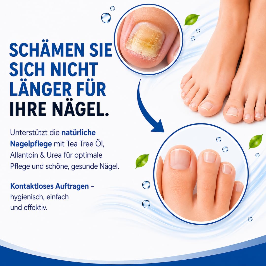 M-cose Nagelöl 100ml – Kosmetische Pflege bei Nagelpilz – Schnell & Intensiv – Wasserfreie Formel mit Teebaumöl & Allantoin – Für brüchige, verdickte & verfärbte Nägel