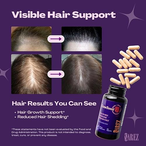 Miniatura 3 de Sarez GlowBoost - Activador de colágeno MSM, sílice de bambú, astaxantina, granada, biotina y semilla de uva, apoya la elasticidad de la piel,