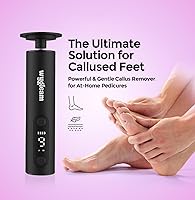 Vista 2 de Removedor eléctrico de callos (negro)