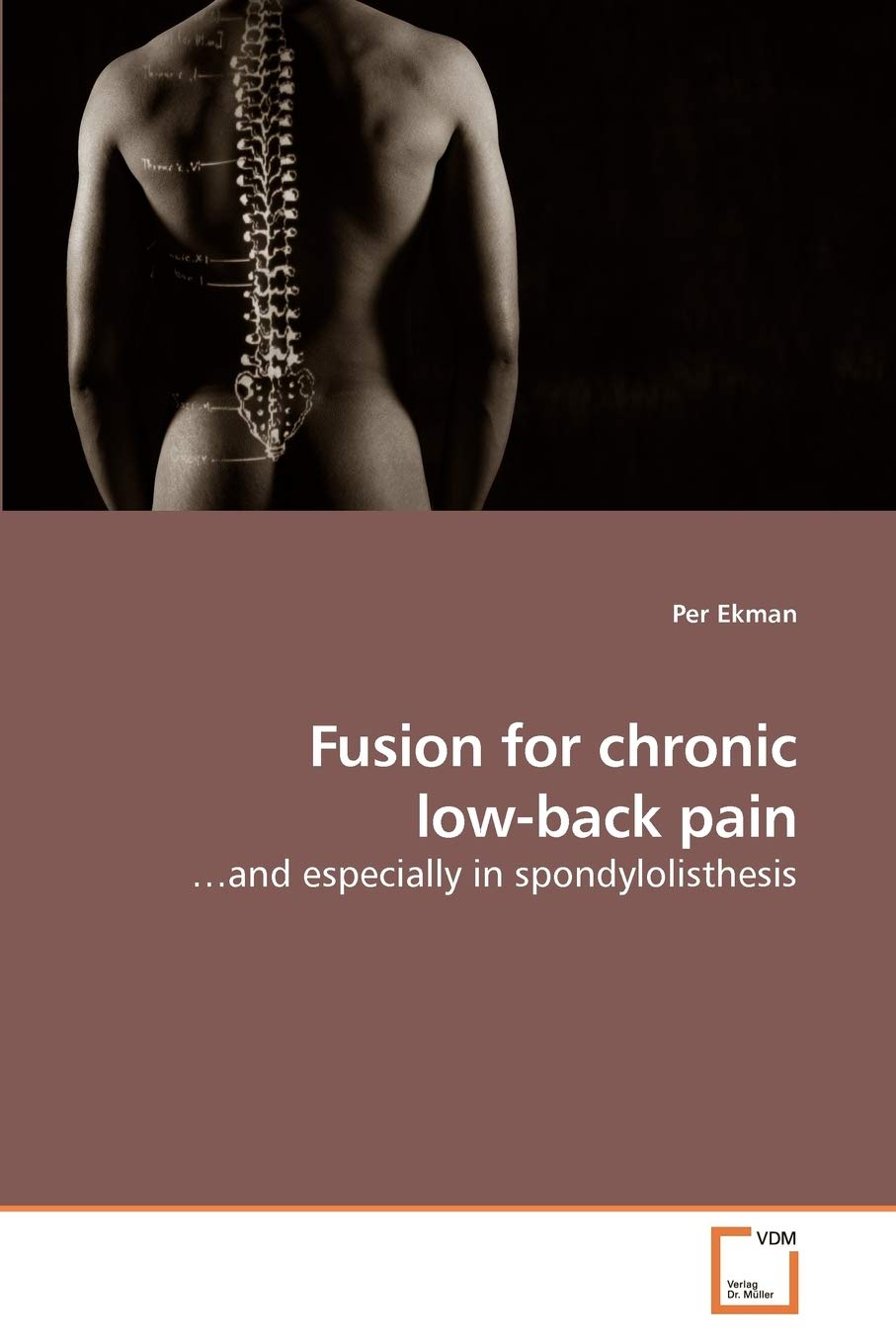 Fusion for chronic low-back pain: ?and especially in spondylolisthesis