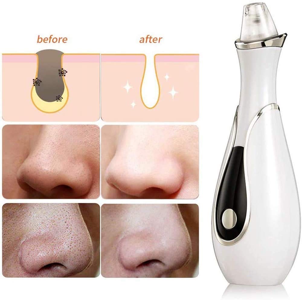 Aspirazione dei punti neri Aspirazione del viso del naso del naso Estrattore di acne strumento di pulizia aggiornato elettrico regolabile sonde di potenza di aspirazione USB ricaricabile Kit per