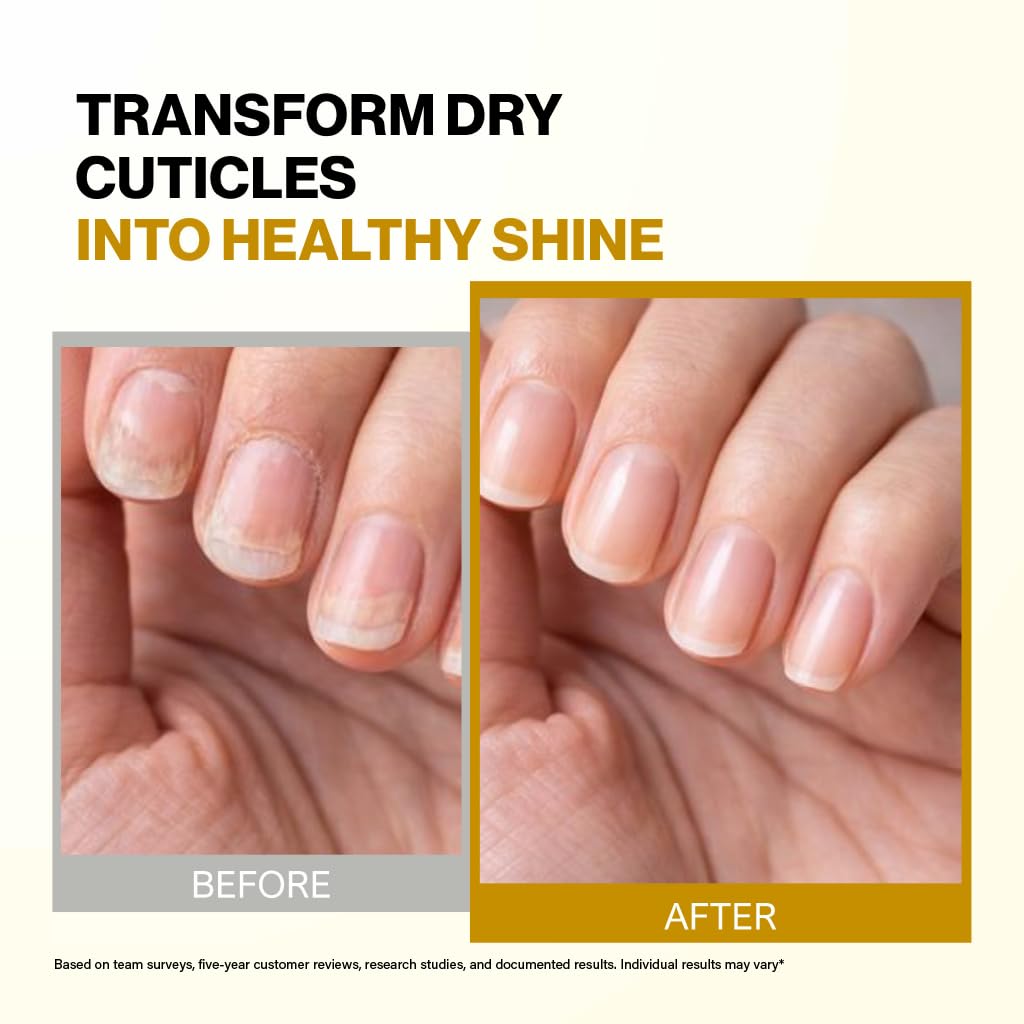 All Natural Nail and Cuticle Oil - Heal Cracked Nails and Rigid Cuticles - Perfect Treatment for Healthy Hands - Moisturizes and Softens - Vitamin E Enriched For Health and Softness by Bee Naturals