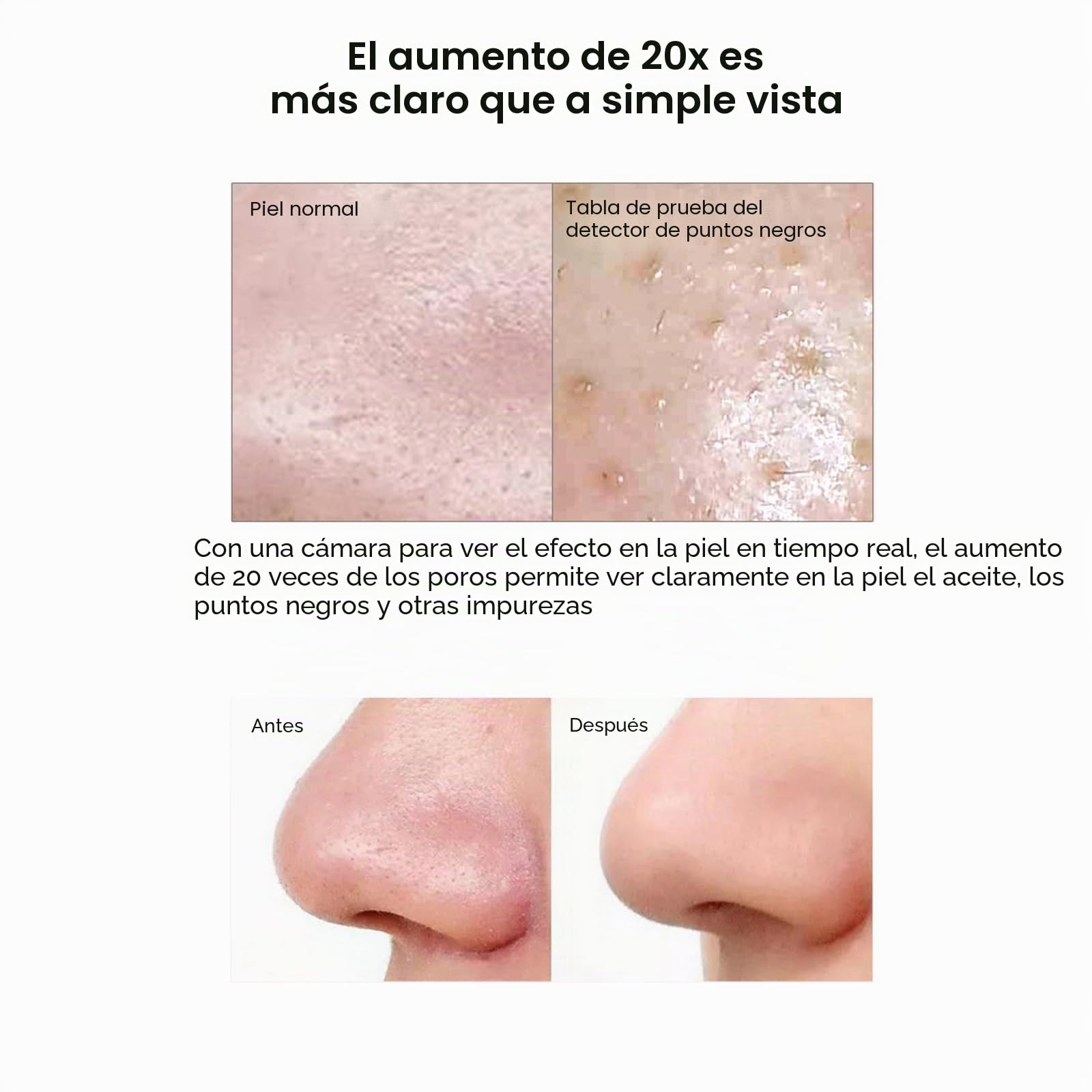 Eliminador de espinillas, limpiador de poros facial, limpiador de poros eléctrico, para puntos negros y acné, dispositivo de limpieza facial, 4 cabezales de aspiración, 6 modos con píxeles HD de 200 W