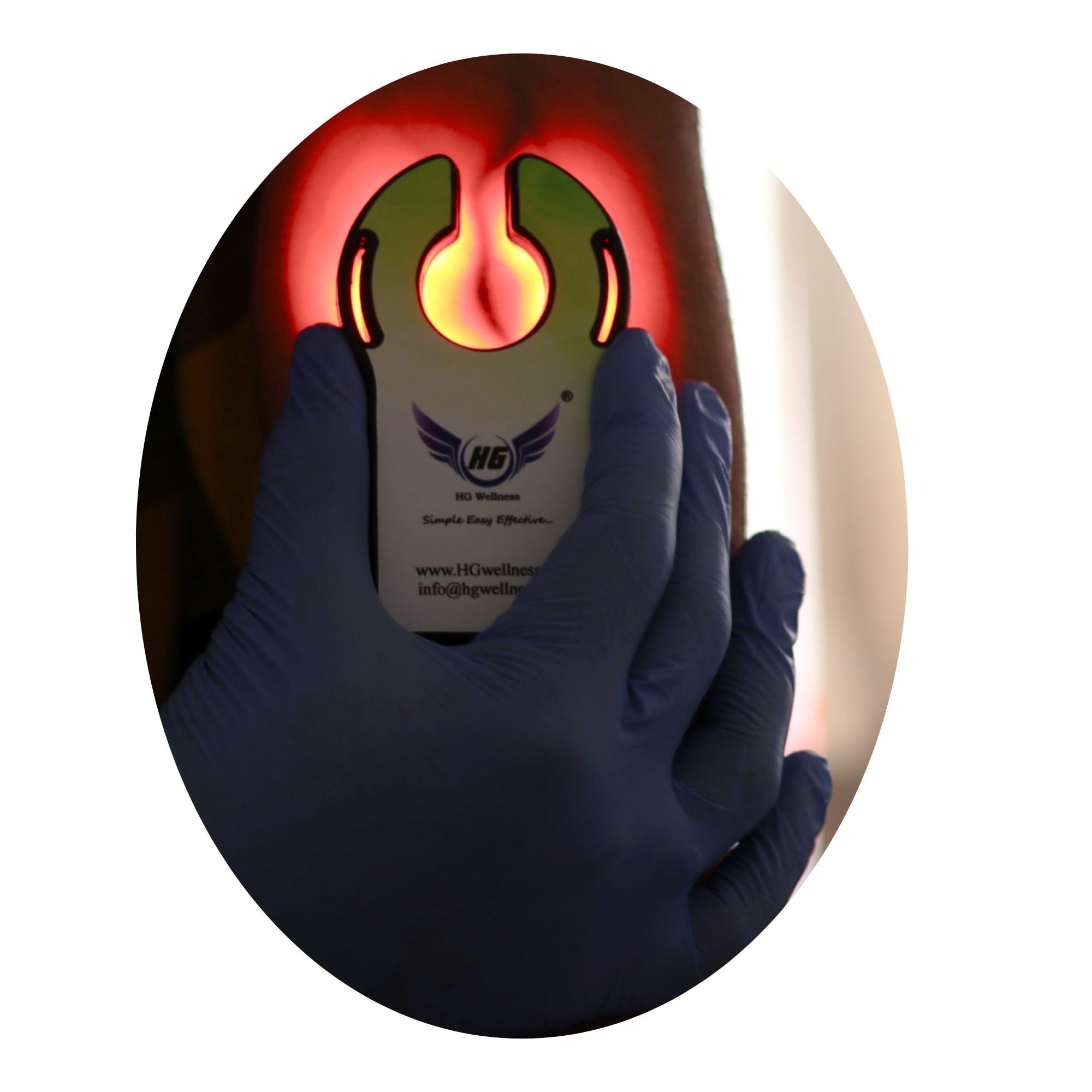 HG Vein Finder HGVF637-2 Specifically Designed for EMTs, Paramedics, anesthetics, Nurses for Performing IV Access on Patients