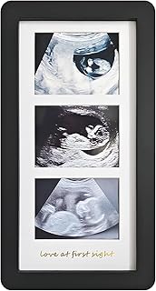 trlry Ultrasound Picture Frames (Black)