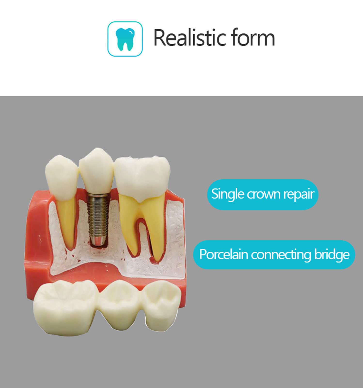 Modello di Denti Analisi, Modello Dentale per Dimostrazione dello Strumento di Insegnamento Dentale in Studio,Denti Analisi Impianto per L'insegnamento e Ricerca Odontoiatrica