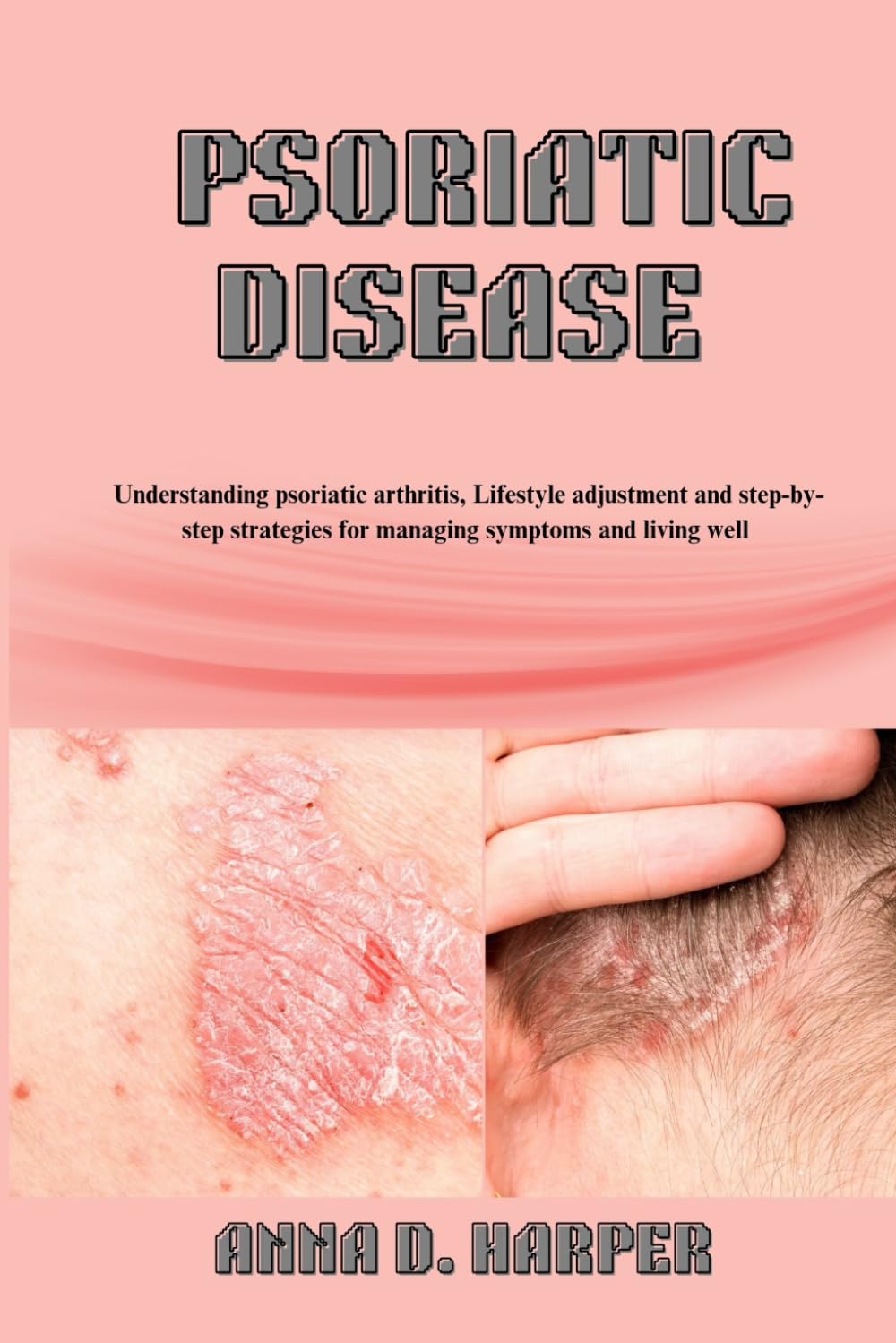 PSORIATIC DISEASE: Understanding Psoriatic Arthritis and Step-by-Step Strategies for Managing Symptoms and Living Well