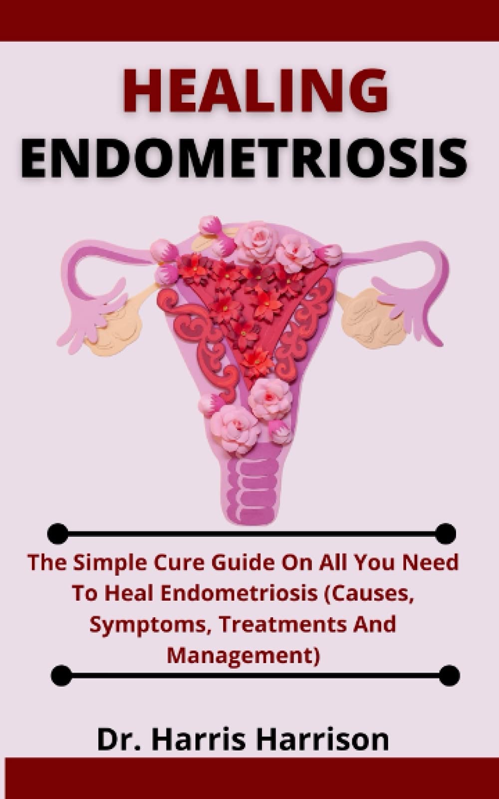 Buy Healing Endometriosis The Simple Cure Guide On All You Need To