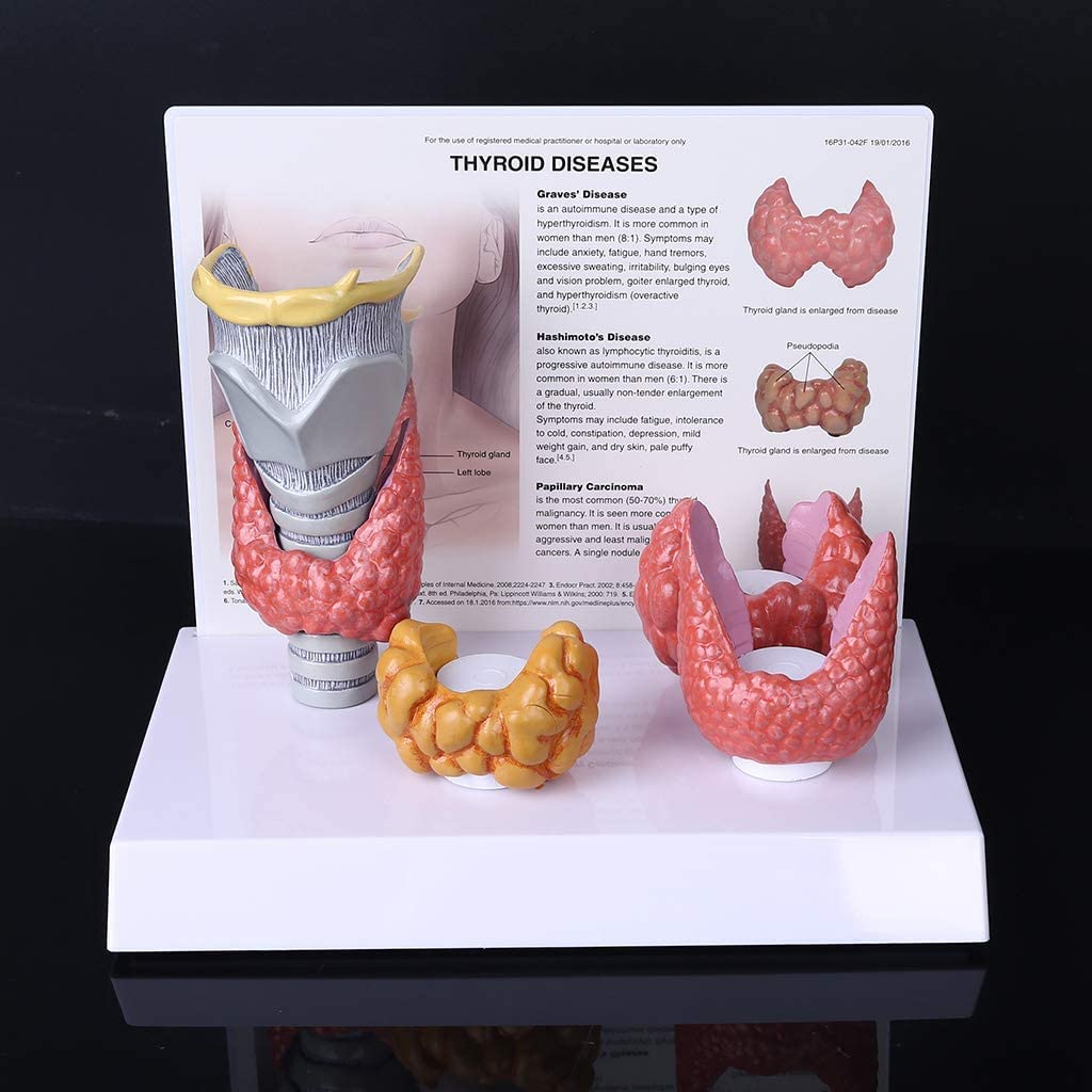 hixswnu Modello di patologia delle lesioni della tiroide Umana - ghiandola tiroidea Anatomica con Sistema digestivo per Lo Studio di Manuale di insegnamento Medico
