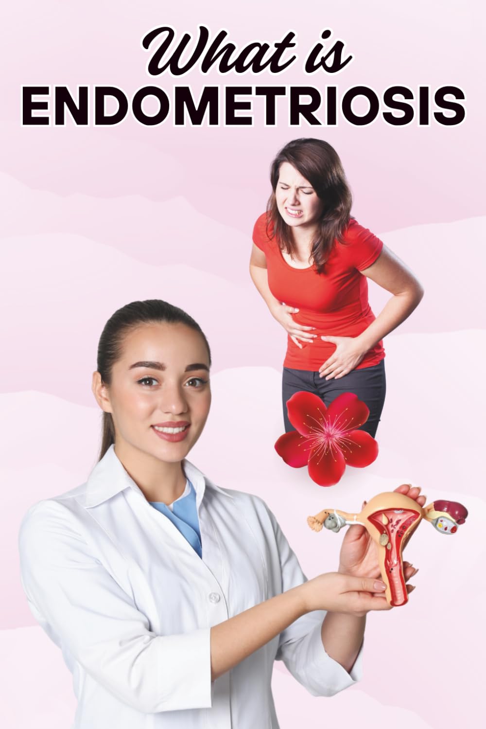 What Is Endometriosis: A Complete Guide to Symptoms, Diagnosis, Treatment, and Living with Chronic Pelvic Pain