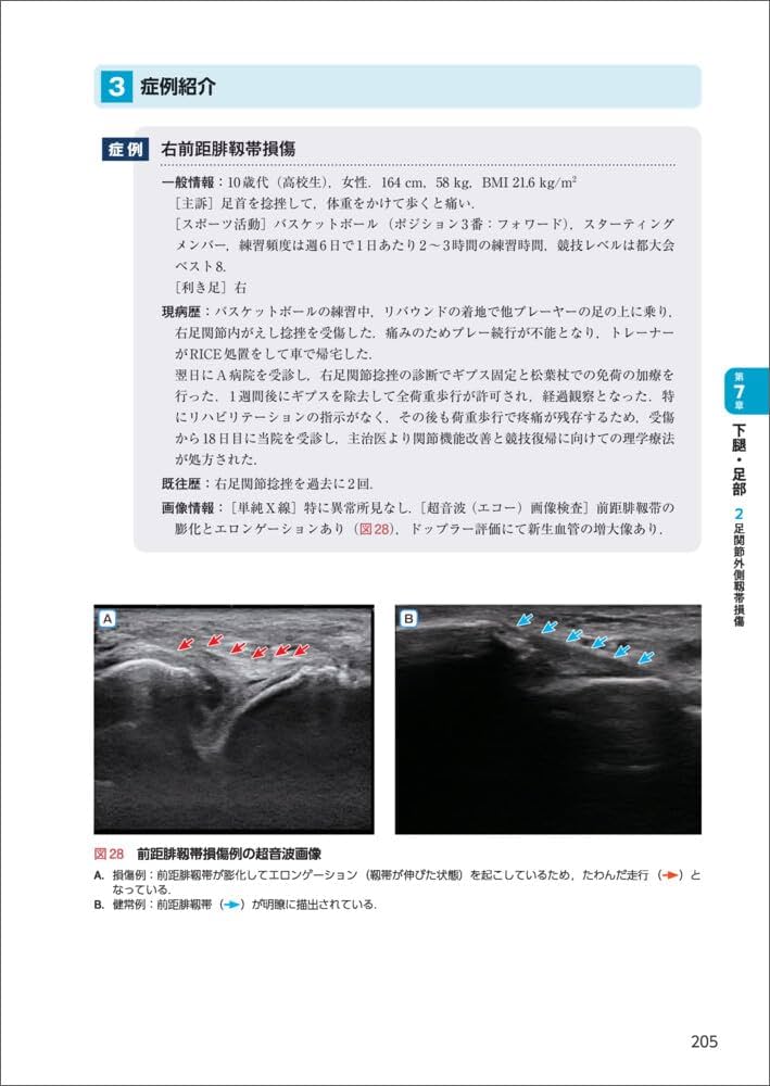 スポーツ理学療法セミナーシリーズ 6冊セット SPTS（スポーツ理学療法セミナー）シリーズ書籍 | 理学療法士
