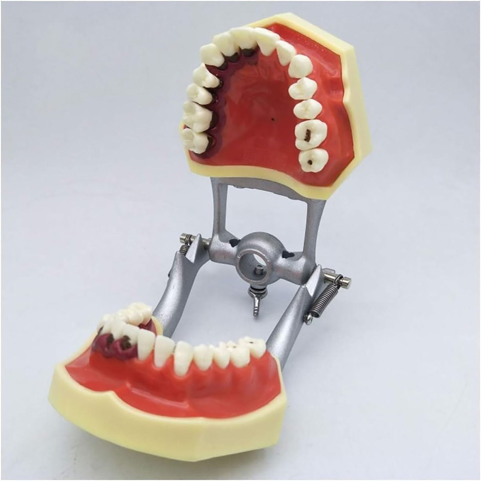 Parodontalpathologisches Zahnmodell mit abnehmbarer Gingiva, Demonstrationsmodell for die zahnmedizinische Patientenaufklärung for Zahnärzte und mündliche Unterrichtskommunikation