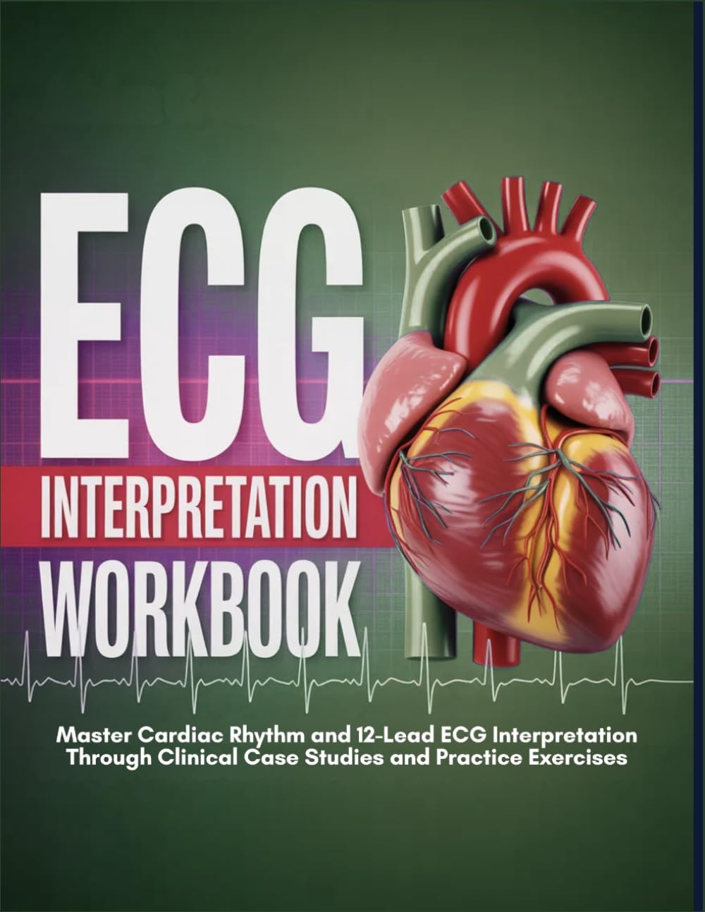 Ecg Interpretation Workbook: Master Cardiac Rhythm And 12-Lead Ecg Interpretation Through Clinical Case Studies And Practice Exercises