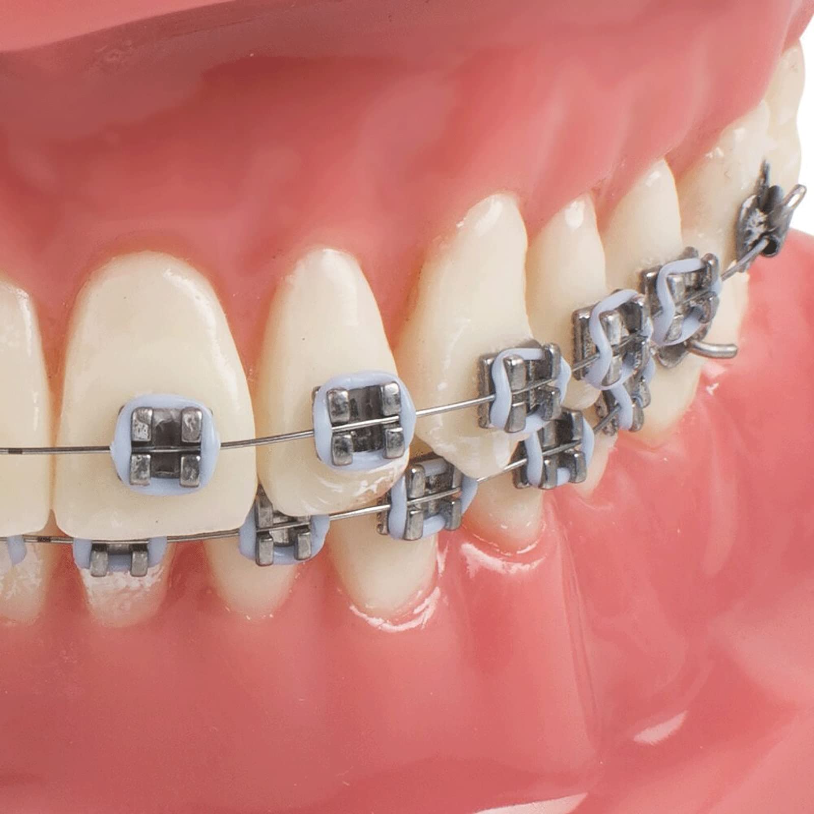 Model Zębów Dentystycznych, Demonstracyjny Model Zębów, Model Zębów Ortodontycznych Z Metalowymi I Ceramicznymi Zamkami