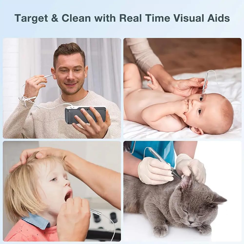 oiakus Ear Wax Removal,1080P Visual Ear Cleaner with 6 LED Light, High-Definition 4.5-inch Smart Large-Screen 3.9mm Diameter Otoscope, White