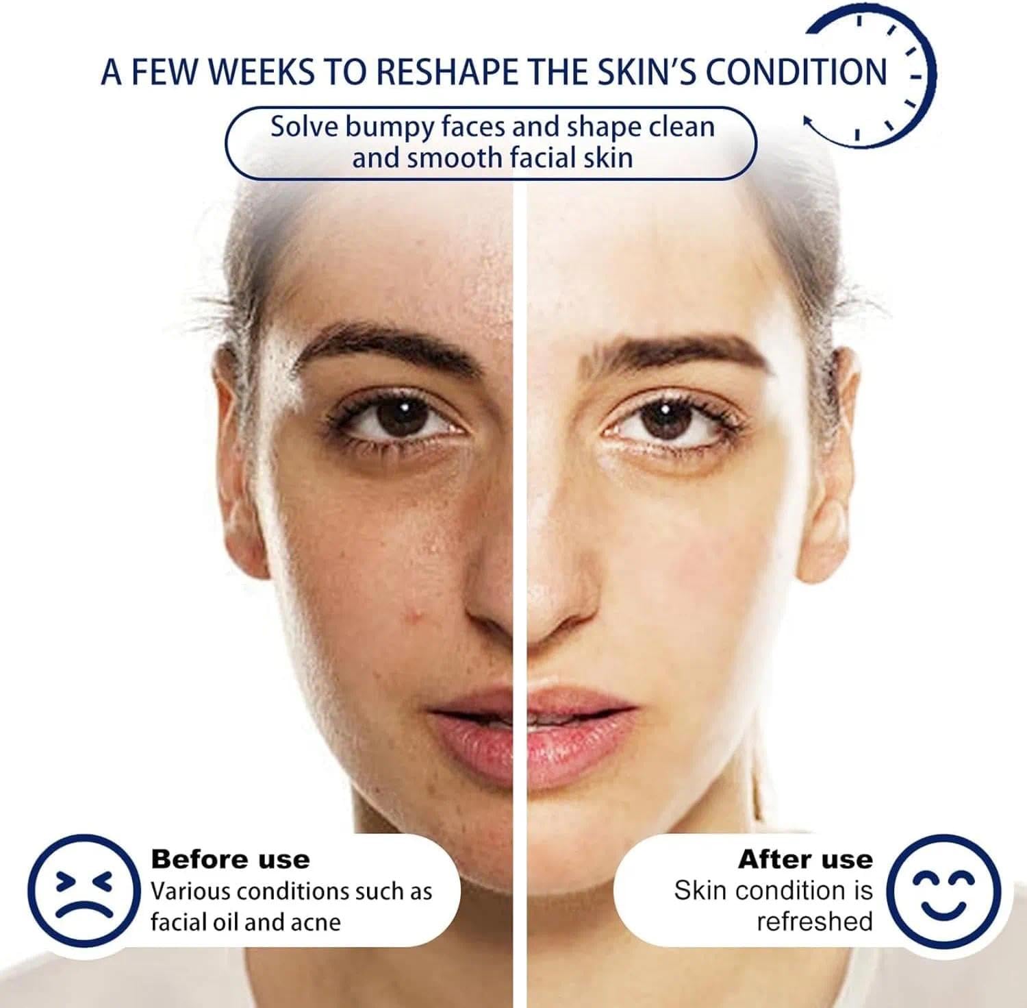 4% Acne Gentle Hydrating Face Cleanser for Women Sensitive Face Wash with Hyaluronic Acid - Image 3