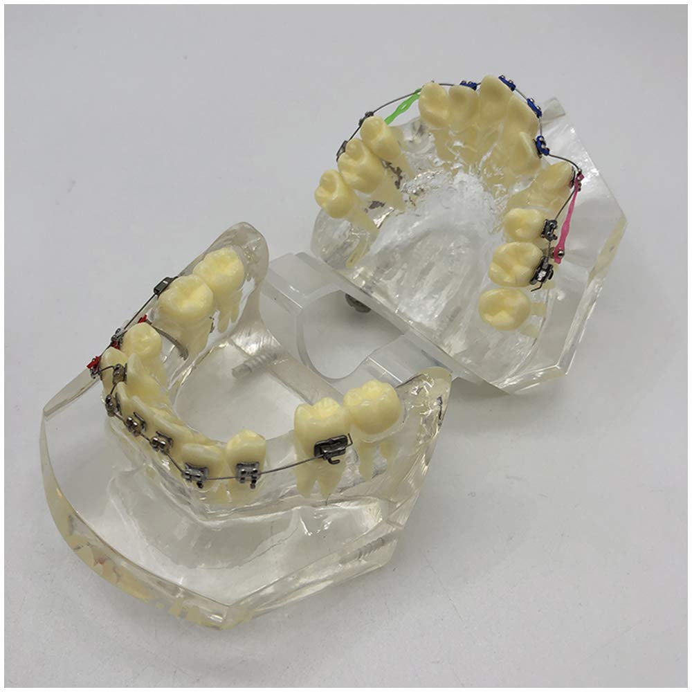Hilitand Dental Model,Dental Orthodontic Treatment Malocclusion Study