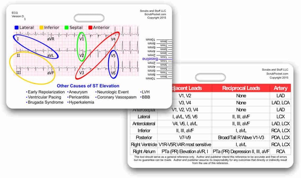 STEMI 12 Lead Tool Horizontal Reference Badge ID Card (Pack of 5)