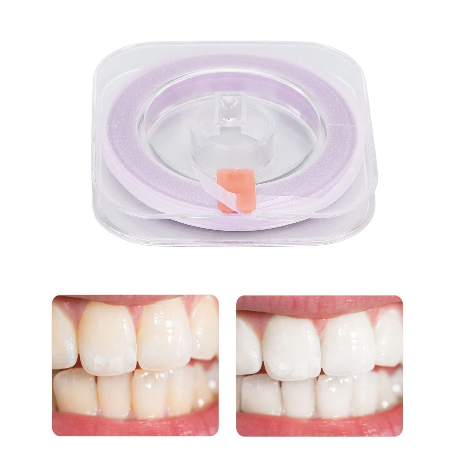 Tiras Dentales Pulidoras Doble Cara 50um Papel De Lija Dental Herramienta De Cuidado Oral