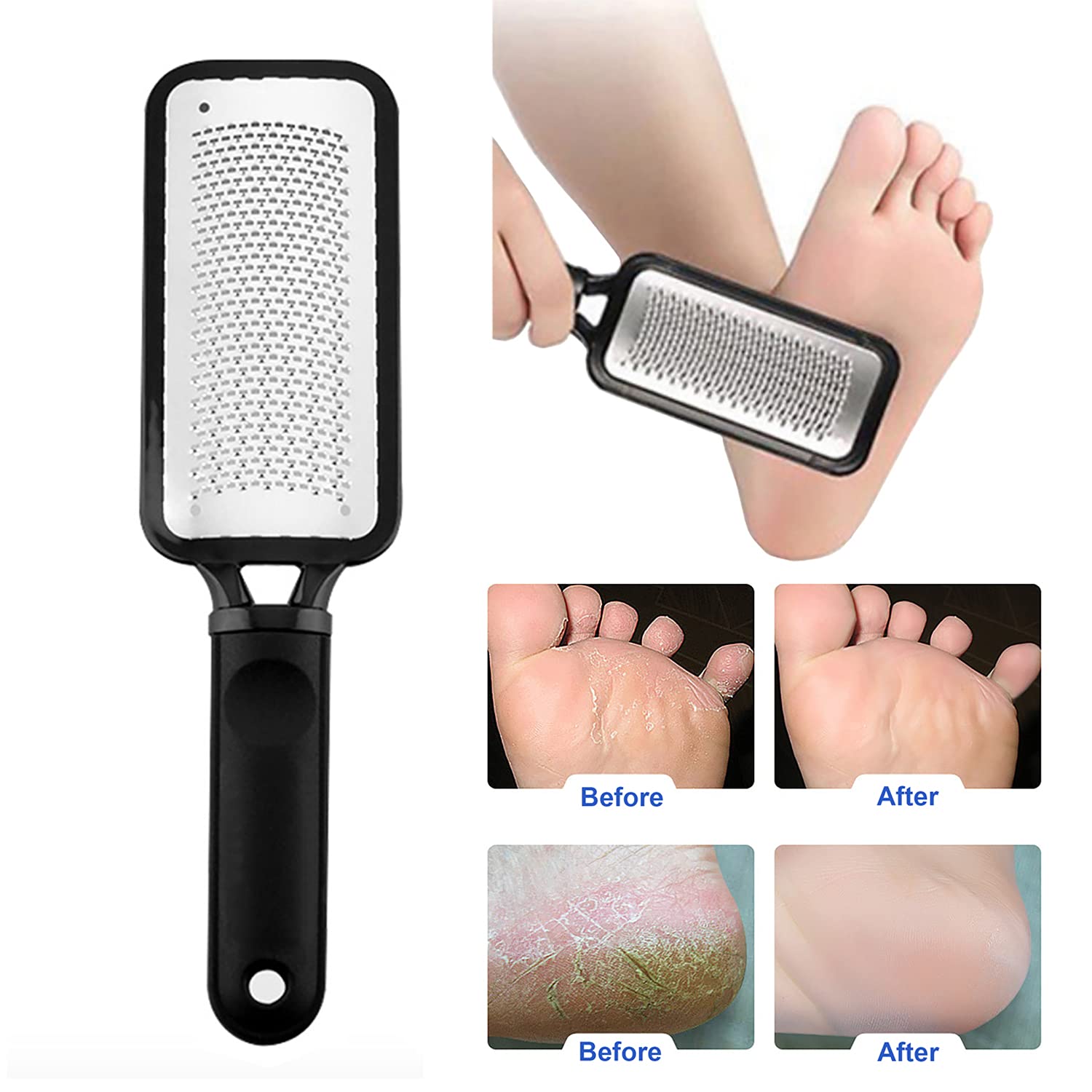 Limas de pies para eliminar callos – Lima profesional de acero inoxidable para el cuidado de los pies, pedicura para eliminar la piel dura (una cara) 6