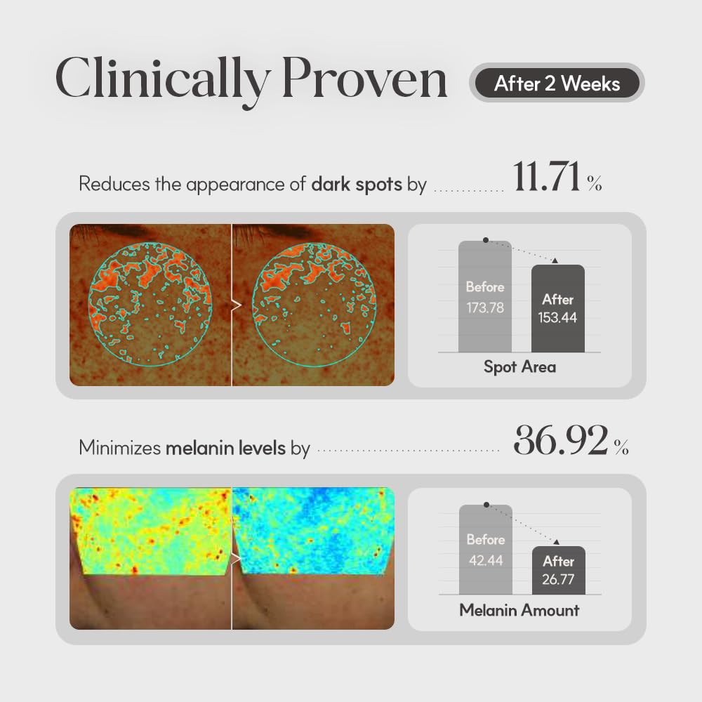 Mela Clinic Cream with NK Cell Technology, Hydrating Cream with Arbutin & Tranexamic Acid for Skin Texture & Tone Balance, 0.5 fl oz - Image 3