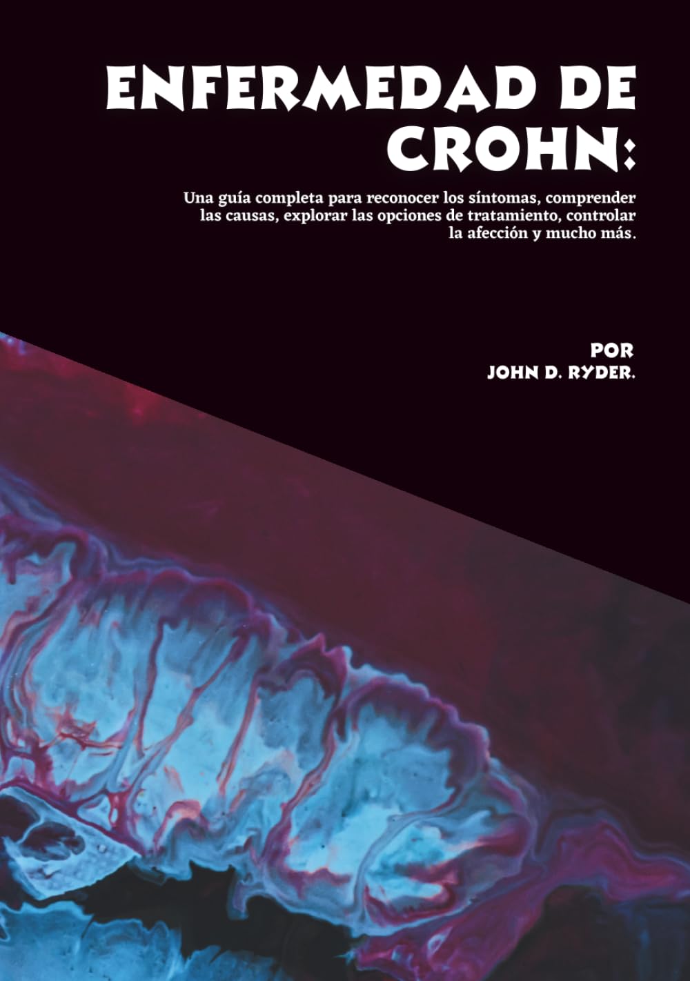 Enfermedad de Crohn: Una guía completa para reconocer los síntomas, comprender las causas, explorar las opciones de tratamiento, controlar la afección y mucho más
